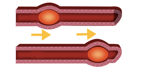 wave-like movements