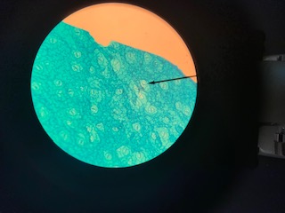 Stomata leaf epidermis, 100x