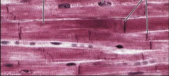 - Cardiac muscle cells are short and fat 
- Intercalated Discs: intercalated discs are made up of desmosomes and gap junction