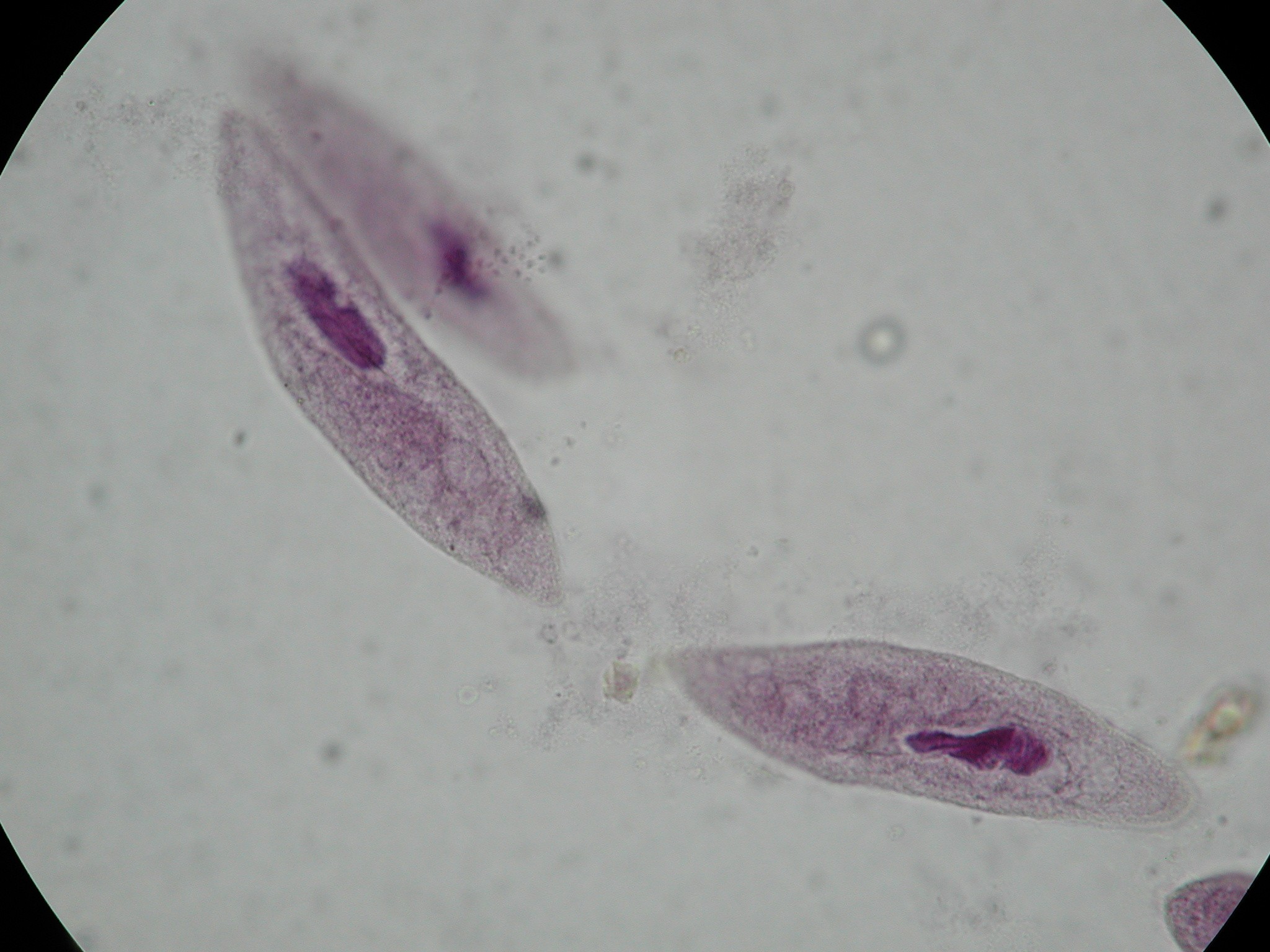 Apicomplexa