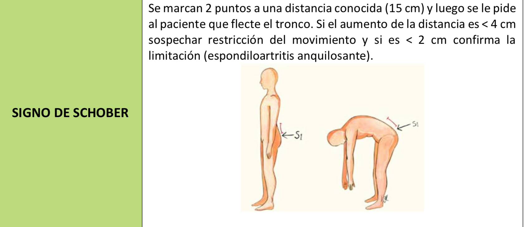 SIGNO DE SHOBER