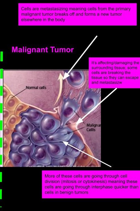 Malignant Tumor
Malignant tumors are more harmful to an organism/humans as they interfere with surrounding tissues and their 