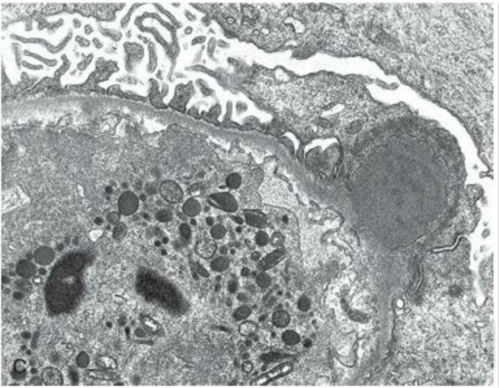 microscopio electrónico