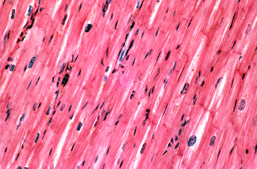 Cardiac Muscle
