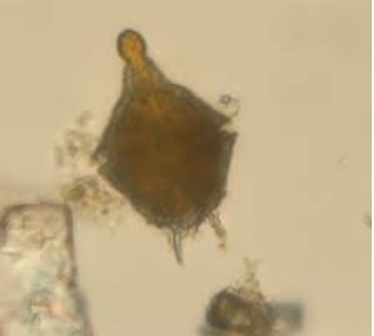 Ex. Gonyaulax
