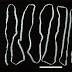Tapeworms