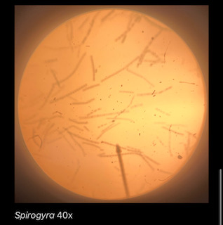 Spirogyra 40x