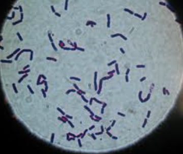 Ex. Bacillus shaped eubacteria