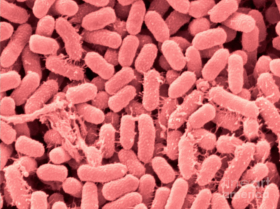 Representative Specie:
- Serratia Marcescens