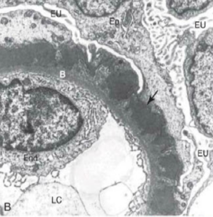 microscopio electónico
