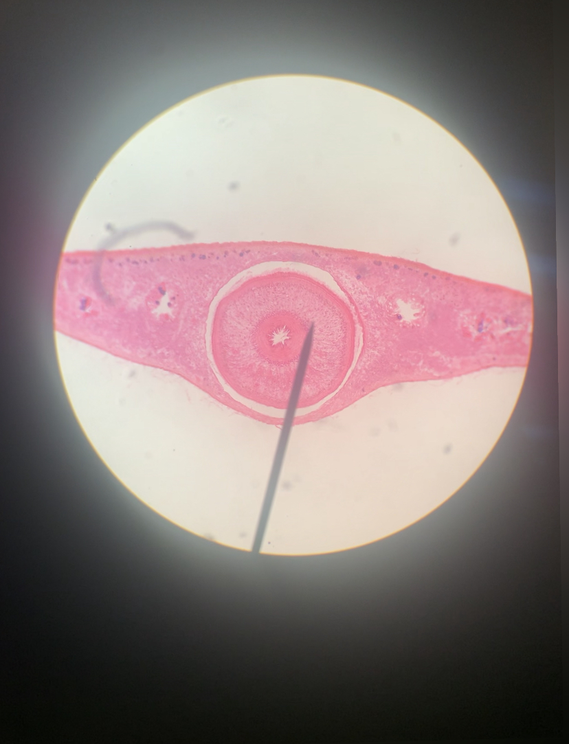 Planarian C.S 400x