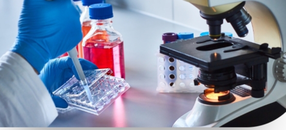 Transplantes de órganos