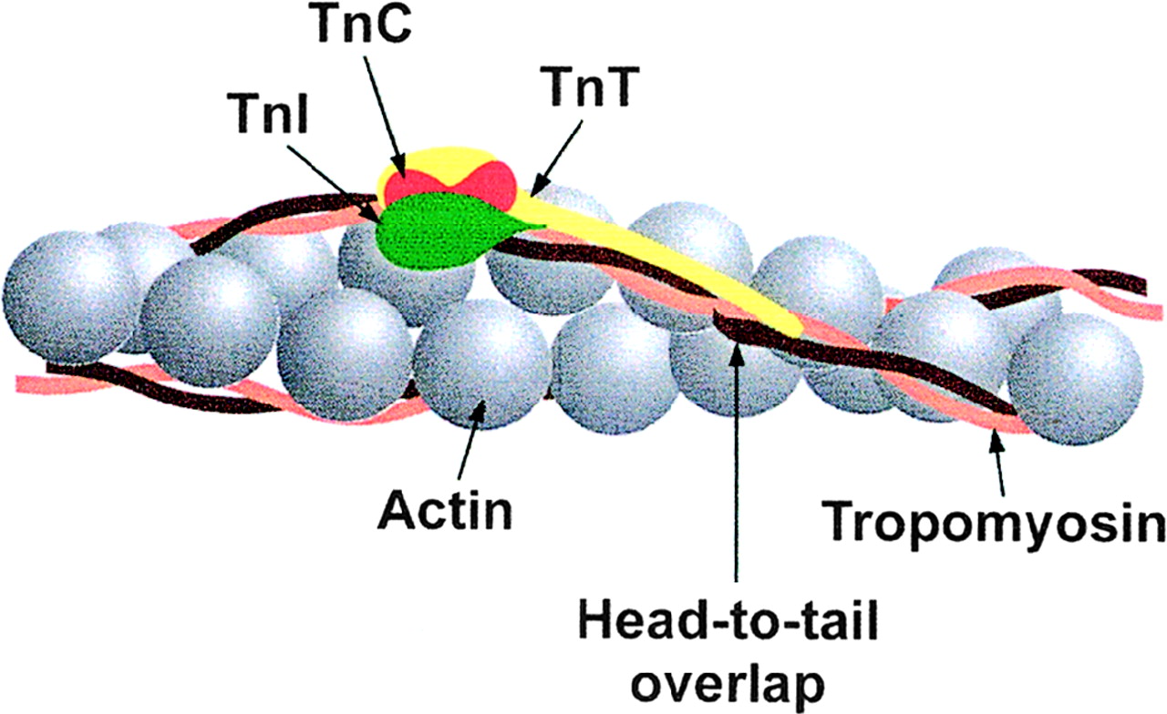Troponina
