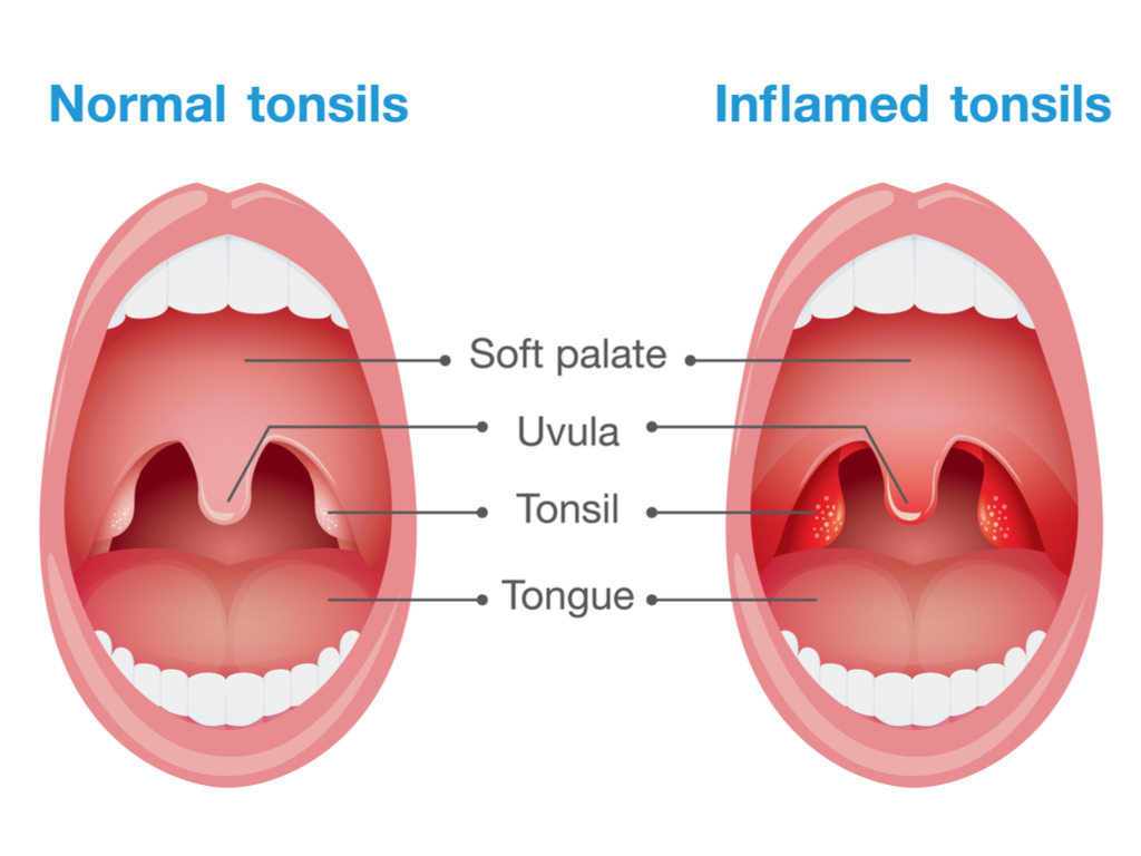Back of your mouth