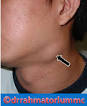 Lymph node