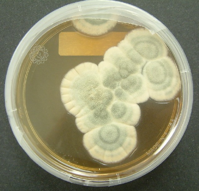 Uses of fungi: