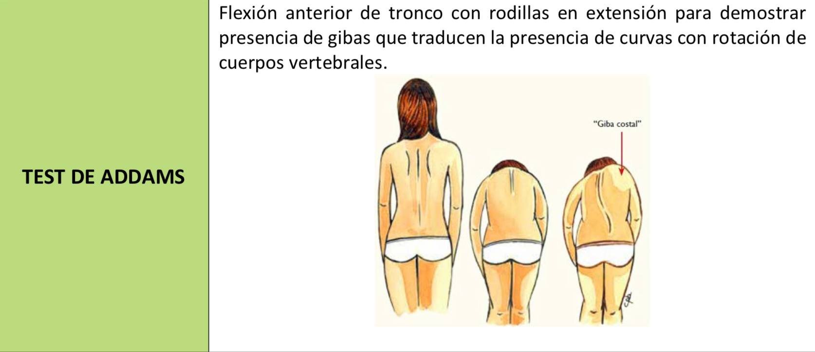 TEST DE ADAMS