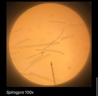 Spirogyra 100x