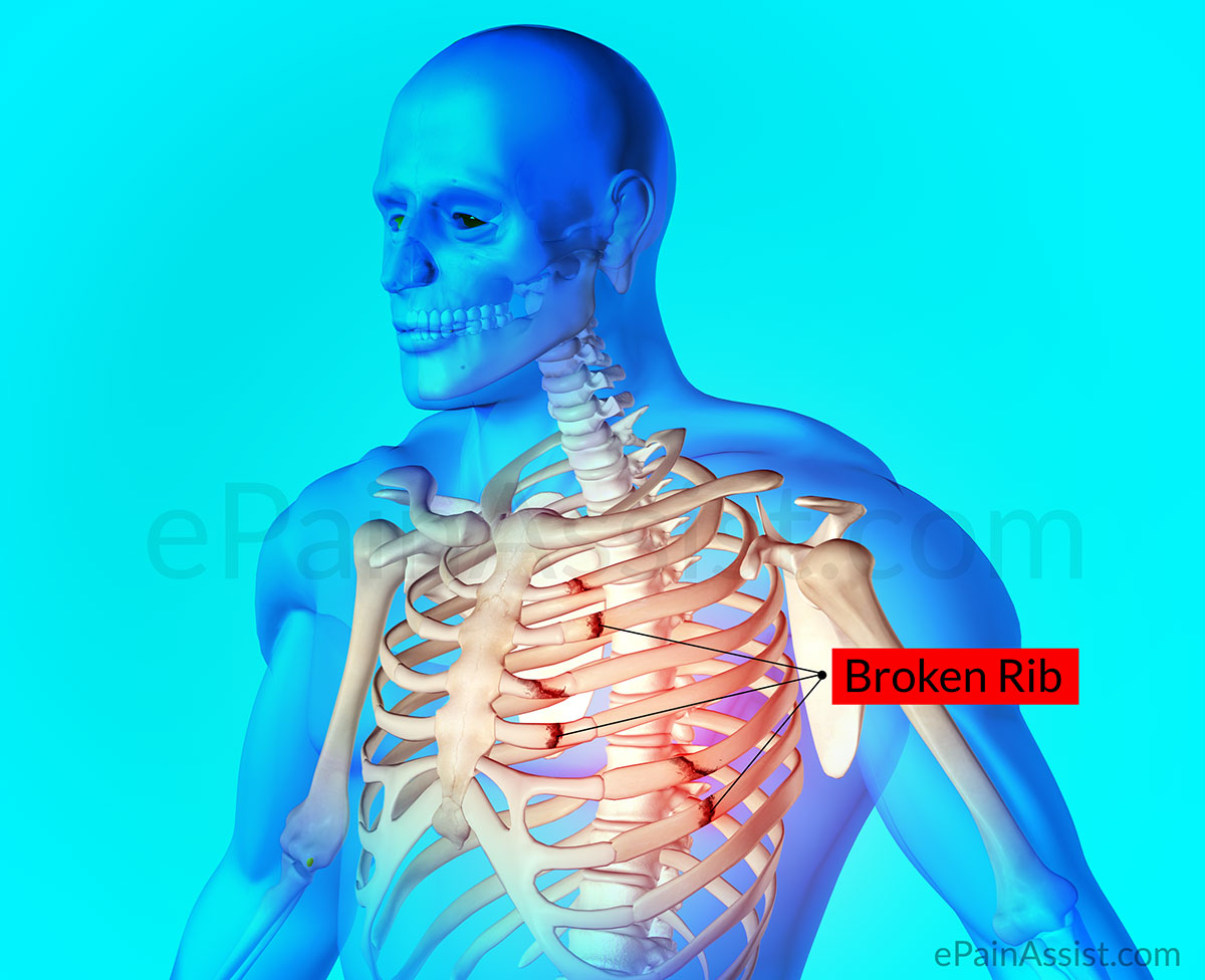 trauma to the chest can cause ribs to break, which in turn causes sharp pains to inner organs