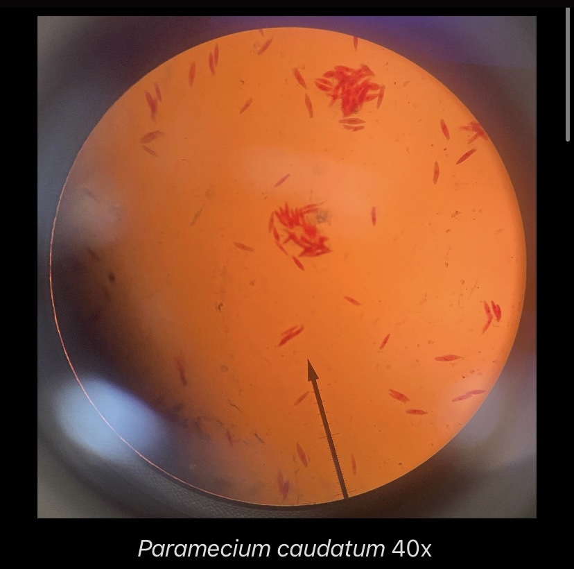 Paramecium caudatum 40x