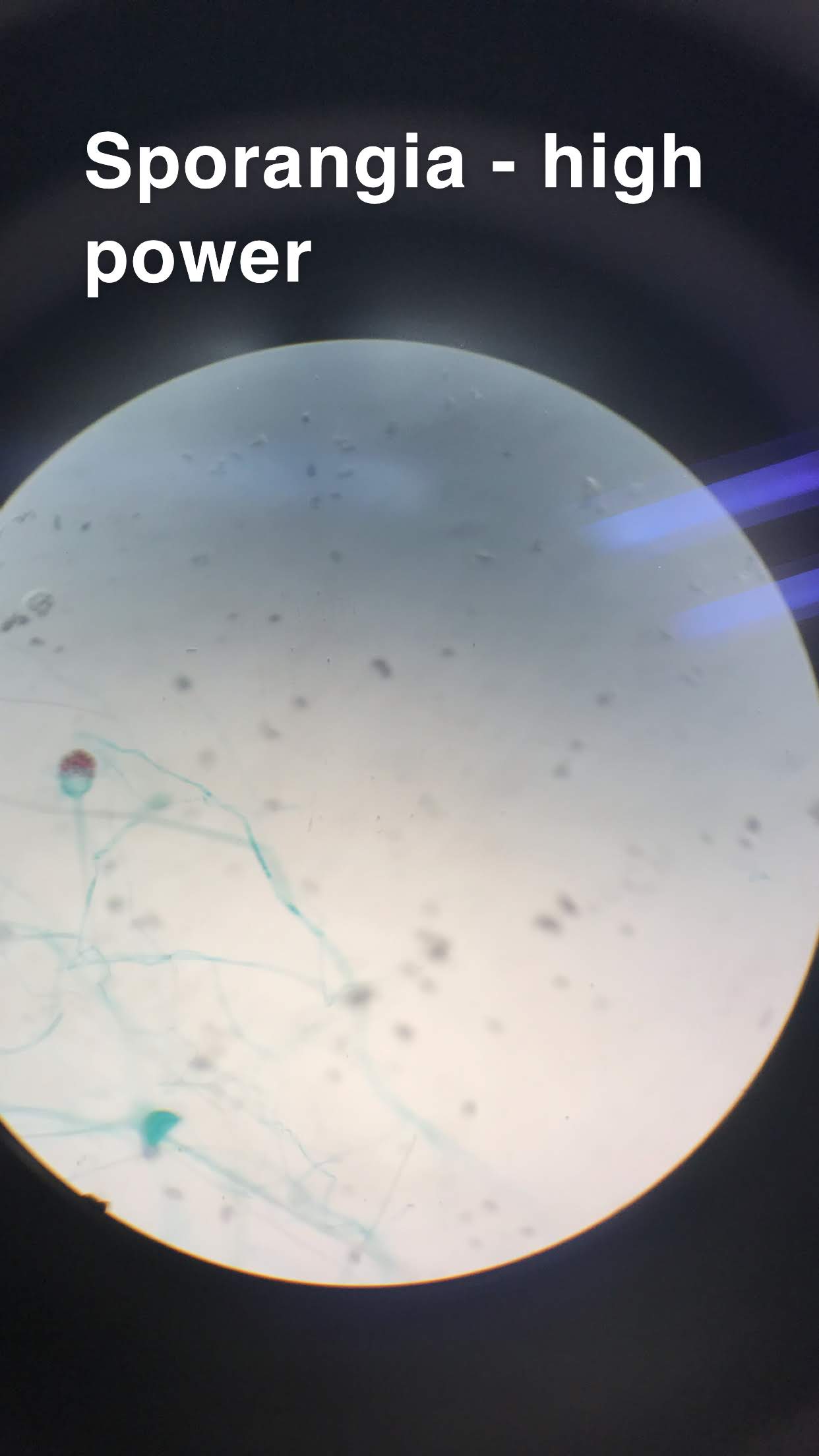 Sporangia