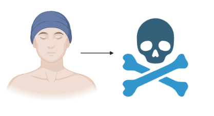2nd leading cause of cancer related death among men in the USA.                                                              