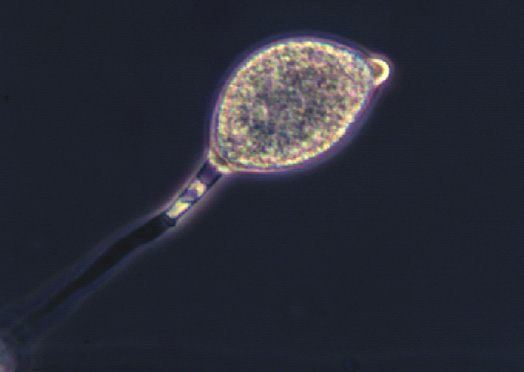 Oomycota