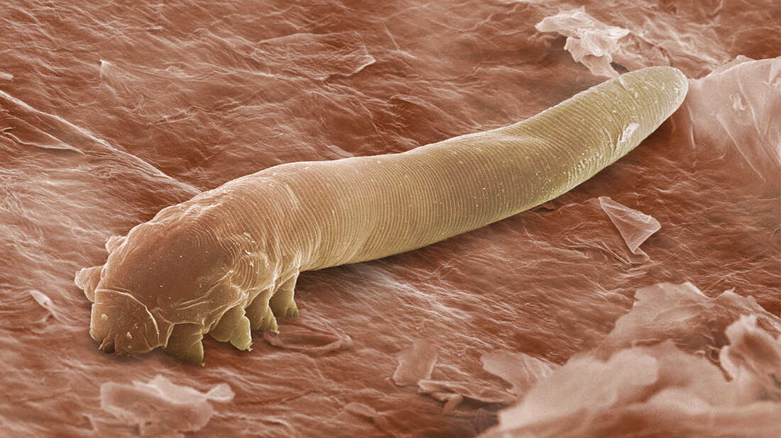 Parasites