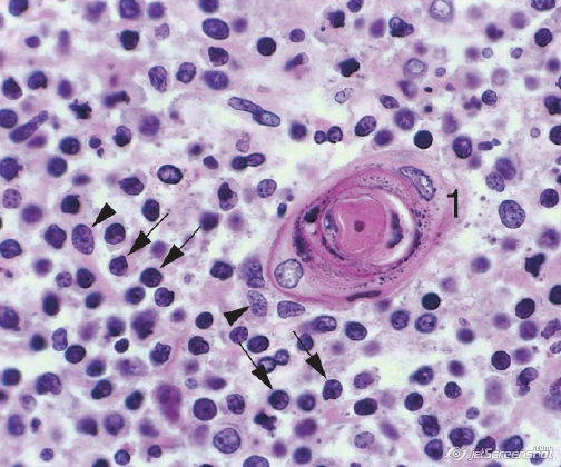 Médula