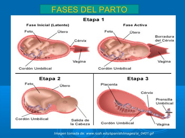 Etapas del parto