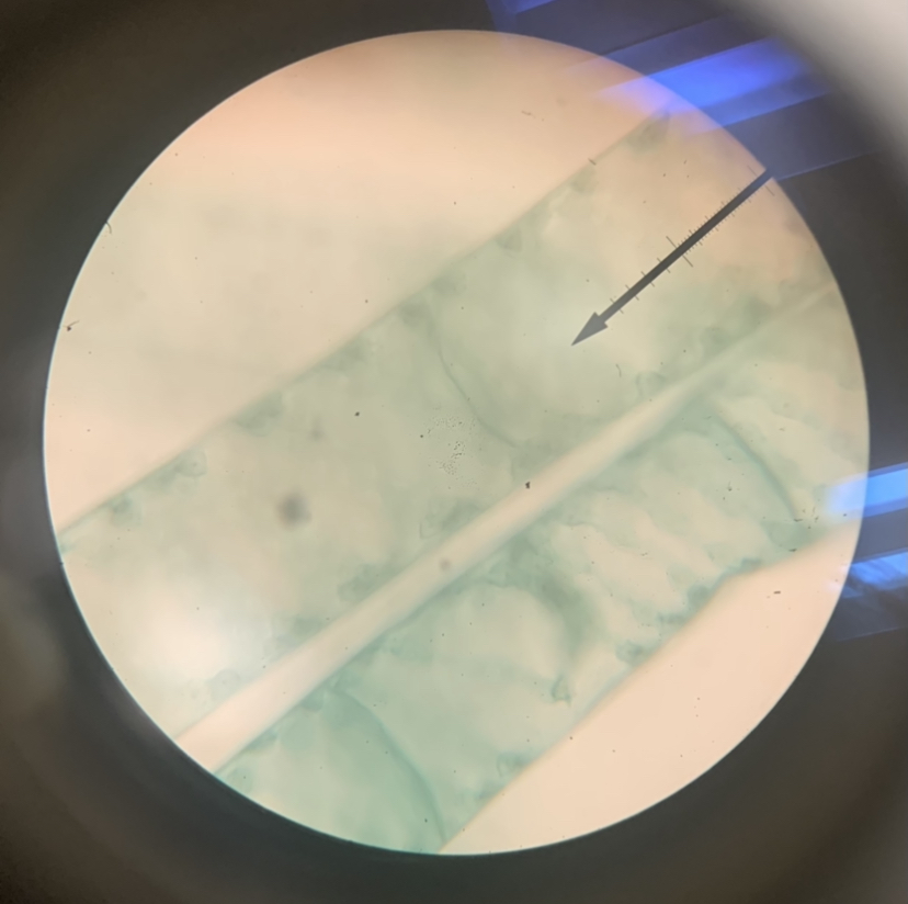 Spirogyra 400x