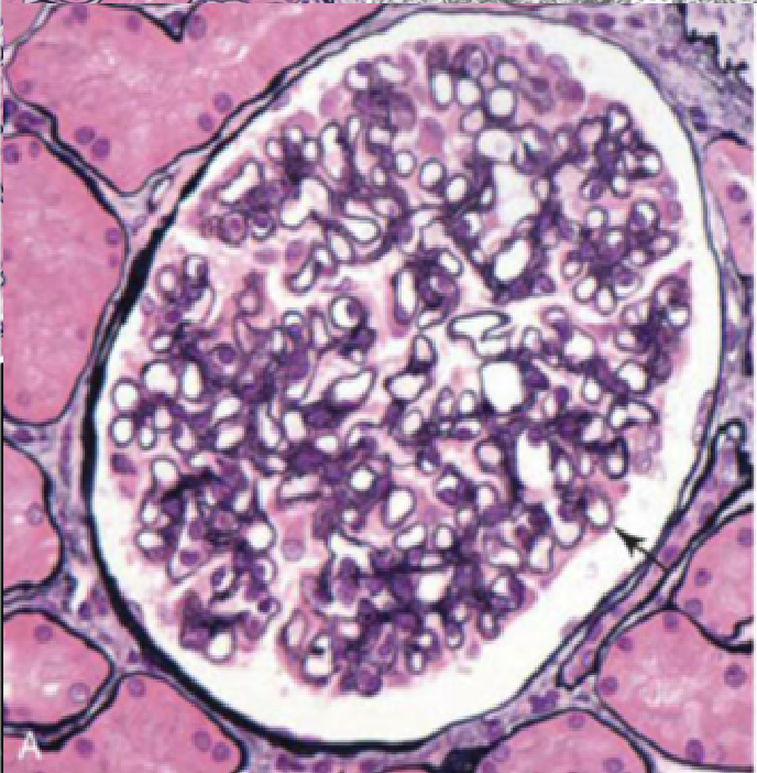 histología