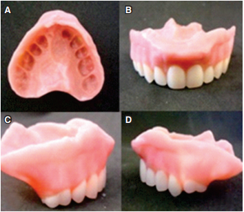 Sobre dentatadura modificada