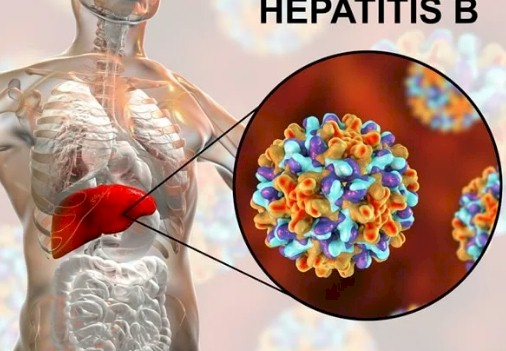Ictericia acompañados de alteraciones importantes del perfil bioquímico hepático