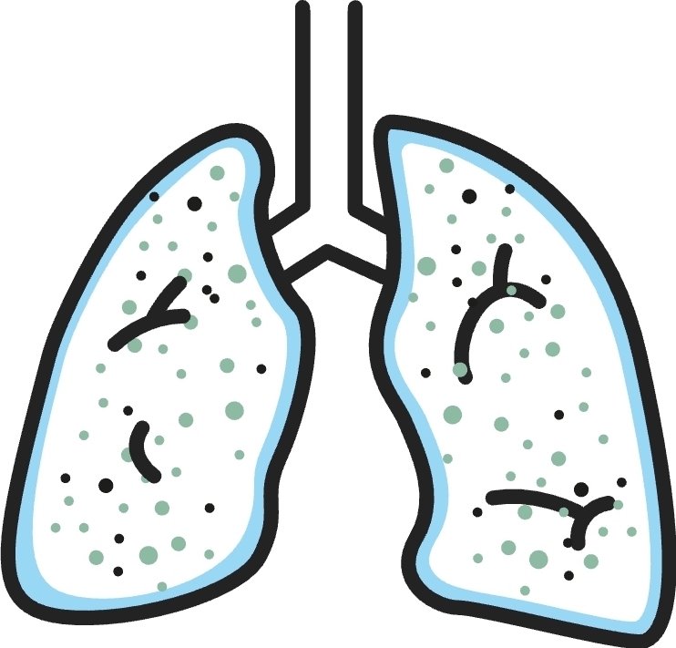 Mucosa que recubre
los bronquios