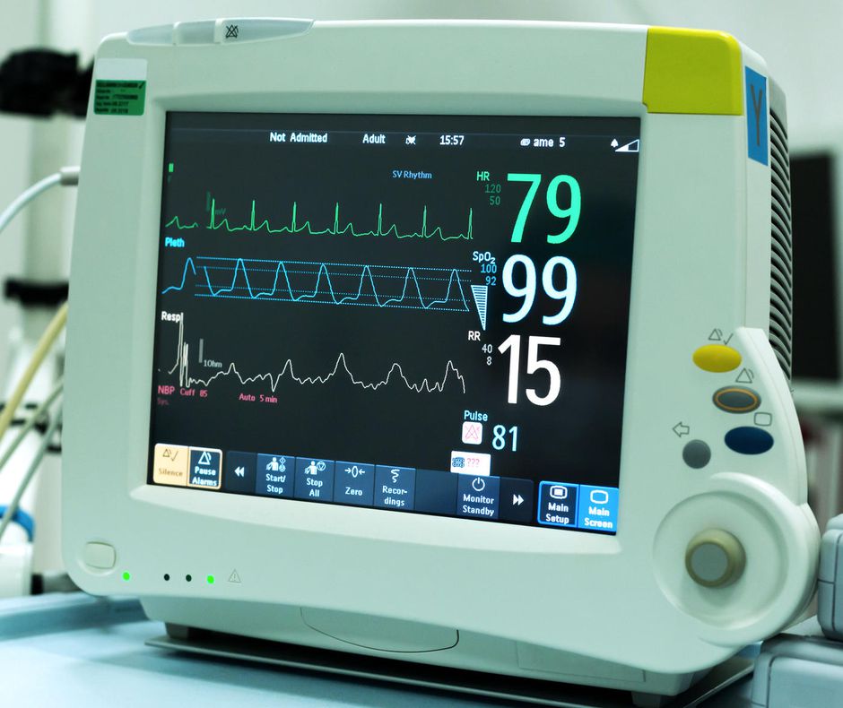 ECG Monitor