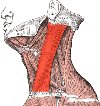 Esternocleidomastoideo
