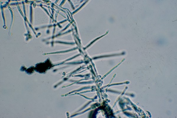 Hyphomycetes