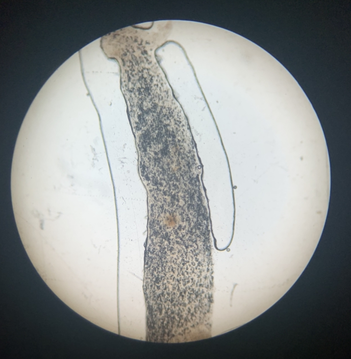 Hyphae of Mushroom 100x