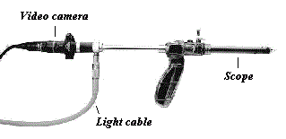 Scope