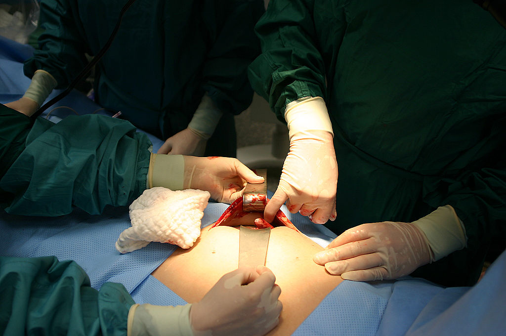 A larger cut will be used
