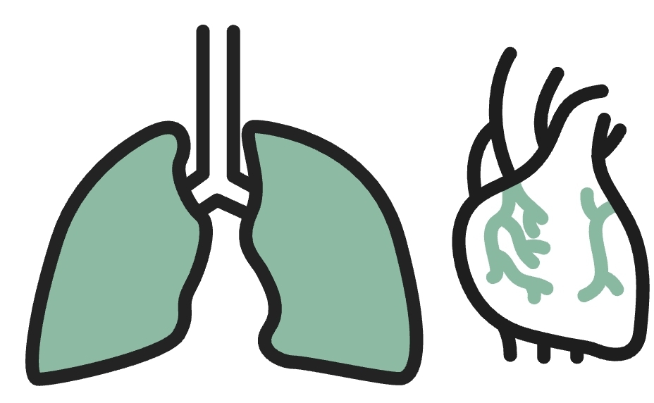 Hipertensión pulmonar