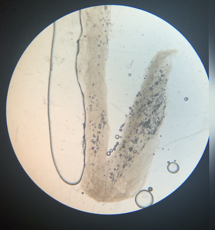 Cap of Mushroom 400x