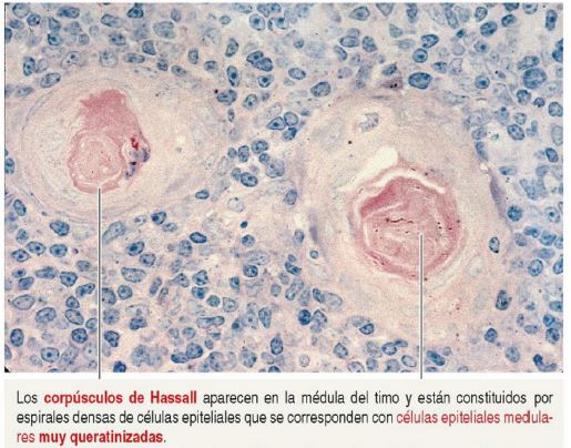 Corúsculos de Hassall