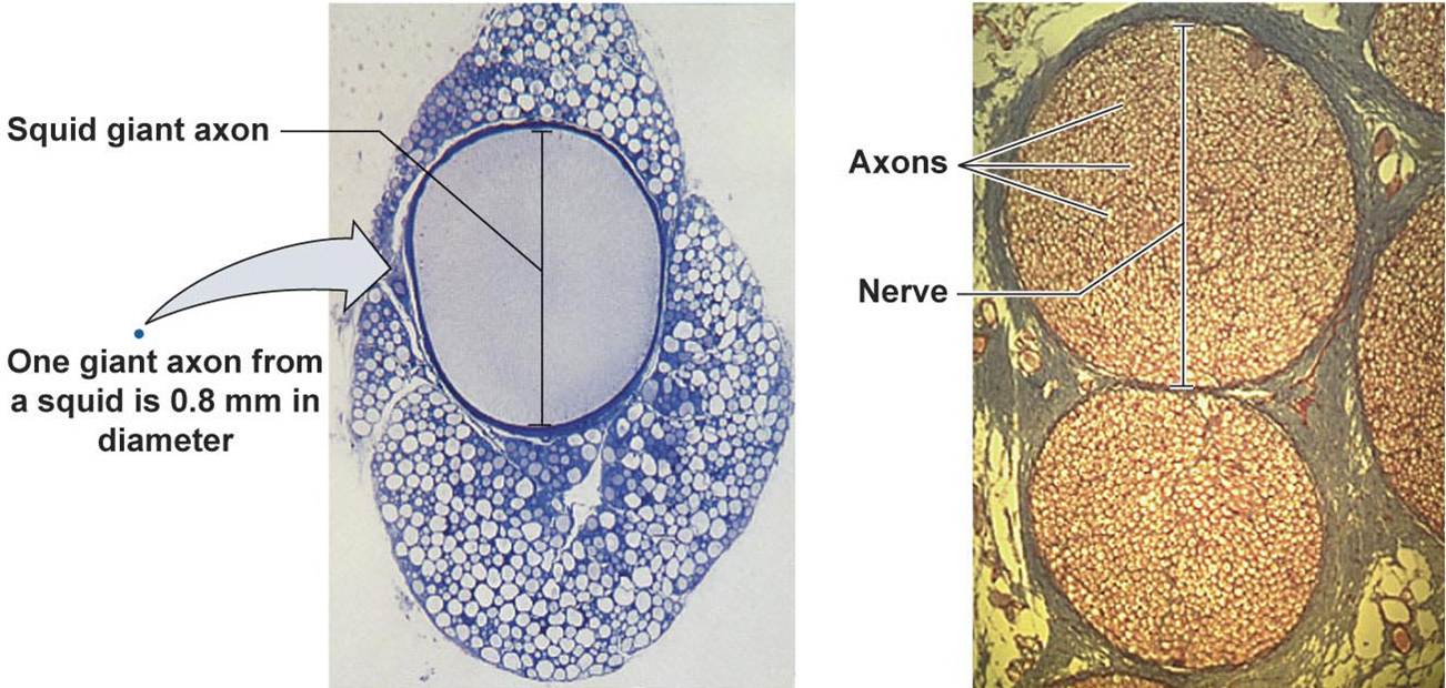 AXON DIAMETER CORRELATES TO THE SPEED OFACTION POTENTIAL CONDUCTION
