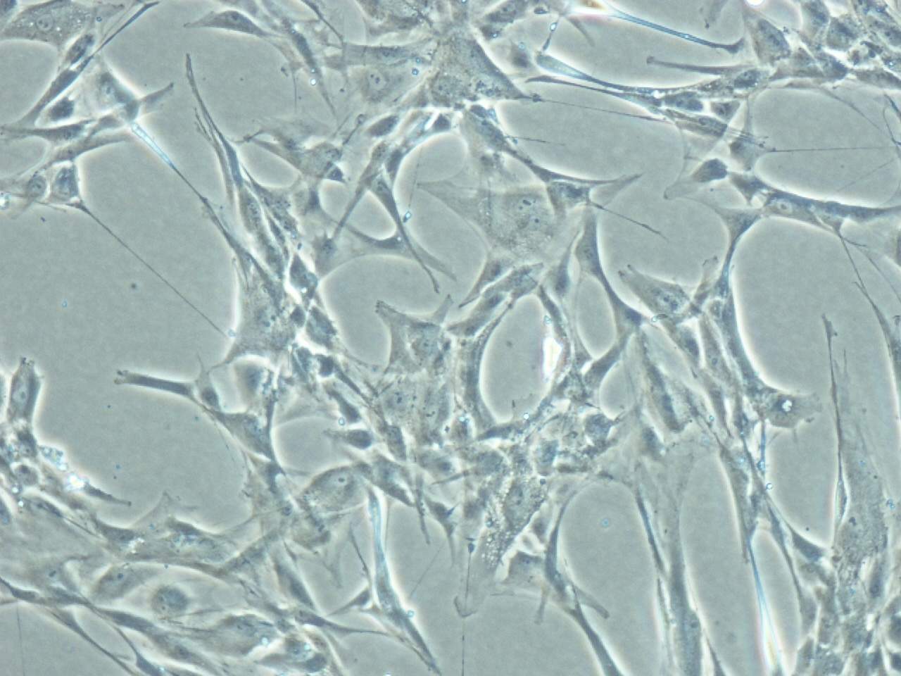 FIBROBLASTO/FIBROCITO