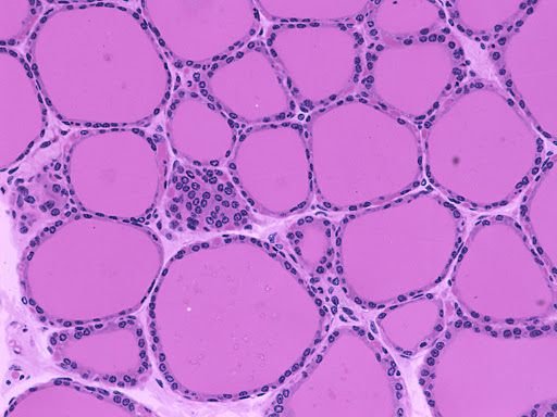 Thyroid epithelial cell