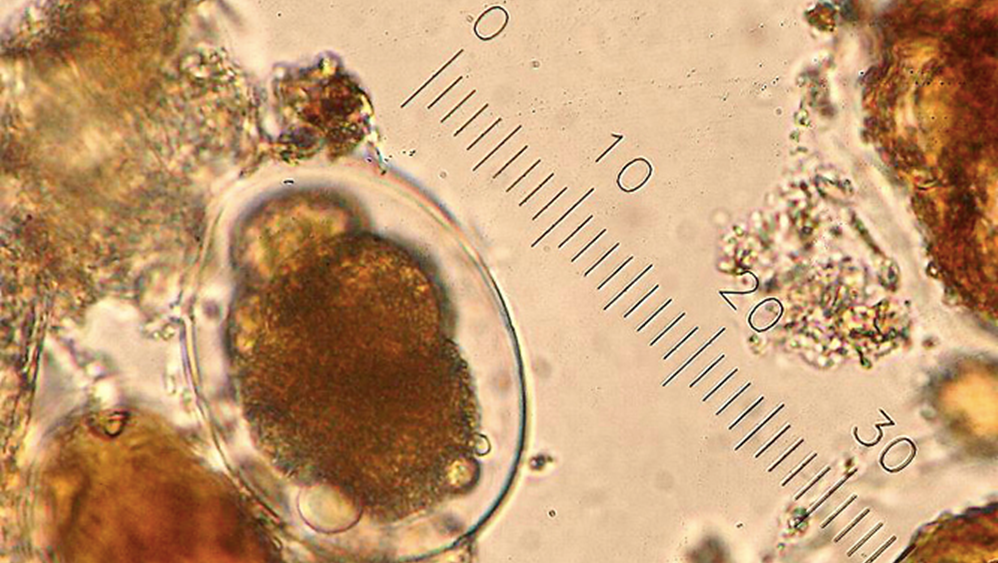 Ancilostomíase
Ancylostoma duodenale & Necator americanus. 
Profa. Dra. Fabiana Brandão