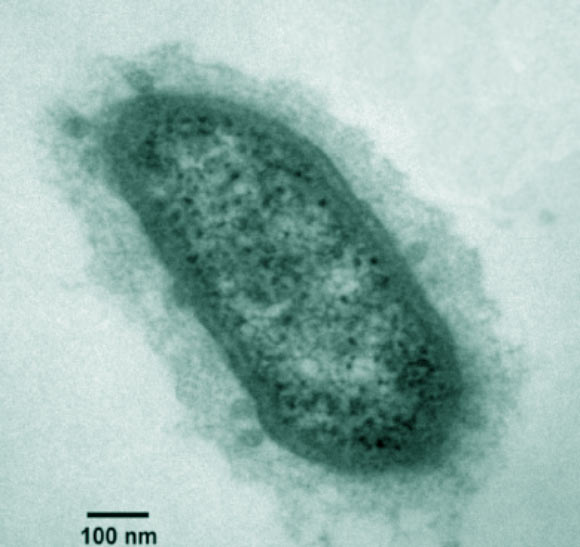 Methanobrevibacter
-Found in human gut
-Cocci shape
-Consumes end products of 
bacterial fermentation
