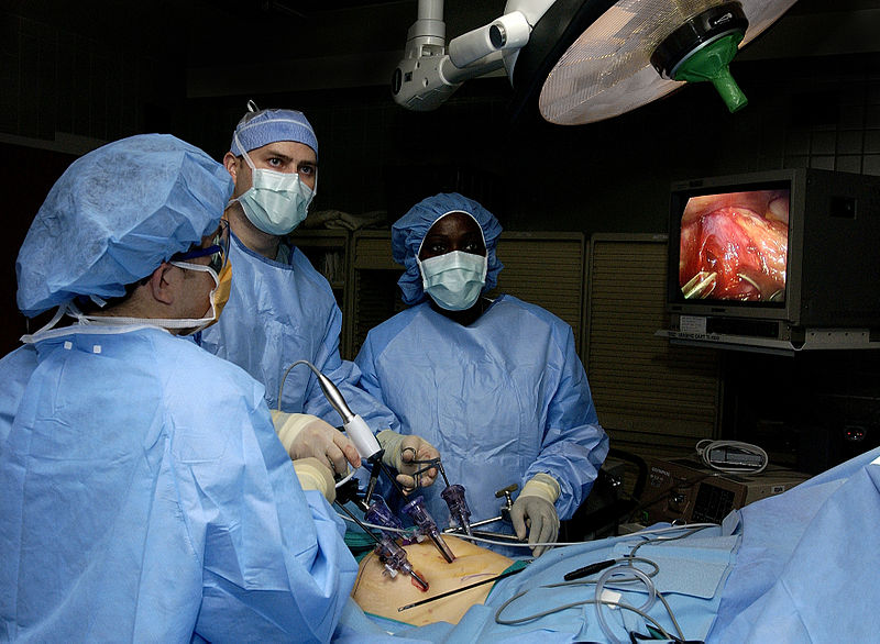 Laparoscopic surgery
